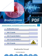 Bradicardias: Características y causas de la bradicardia sinusal, el bloqueo AV y las arritmias ventriculares