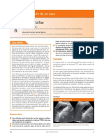 litiasis caso clinico 2.pdf