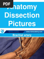 Dissection Anatomy Upper Limb