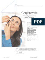 Conjuntivitis: Sintomatología, Tratamiento y Medidas Preventivas