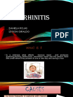 Rhinitis: Daniela Rojas Leyson Giraldo
