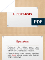 Epistaksis