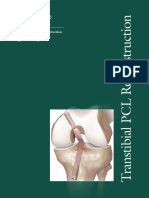 Transtibial PCL Reconstruction Surgical Technique