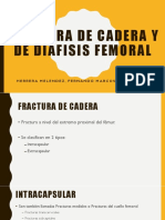 Fractura de Cadera y de Diafisis Femoral