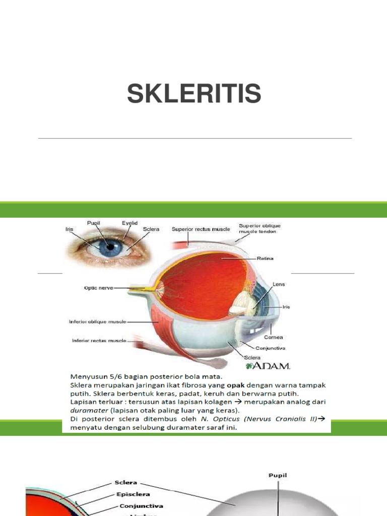 Skleritis 19 PDF