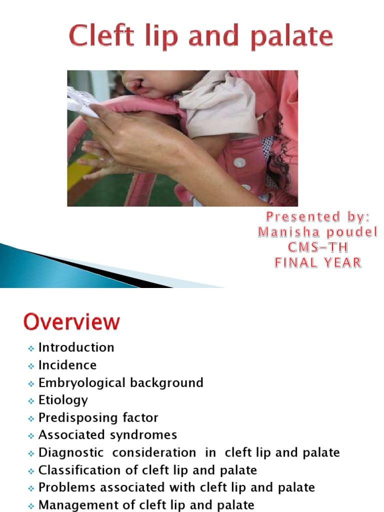 Cleft Lip and Palate: Overview and Classifications | PDF | Orthodontics ...