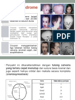 Crouzon Syndrome