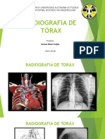 Torax Radiografias