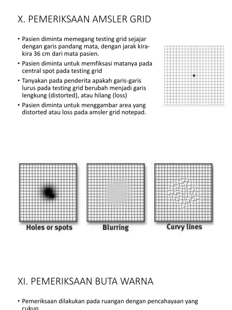 pemeriksaan amsler grid pdf