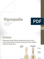 Hipospadia