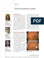 Corticoides - Efectos oculares secundarios.pdf