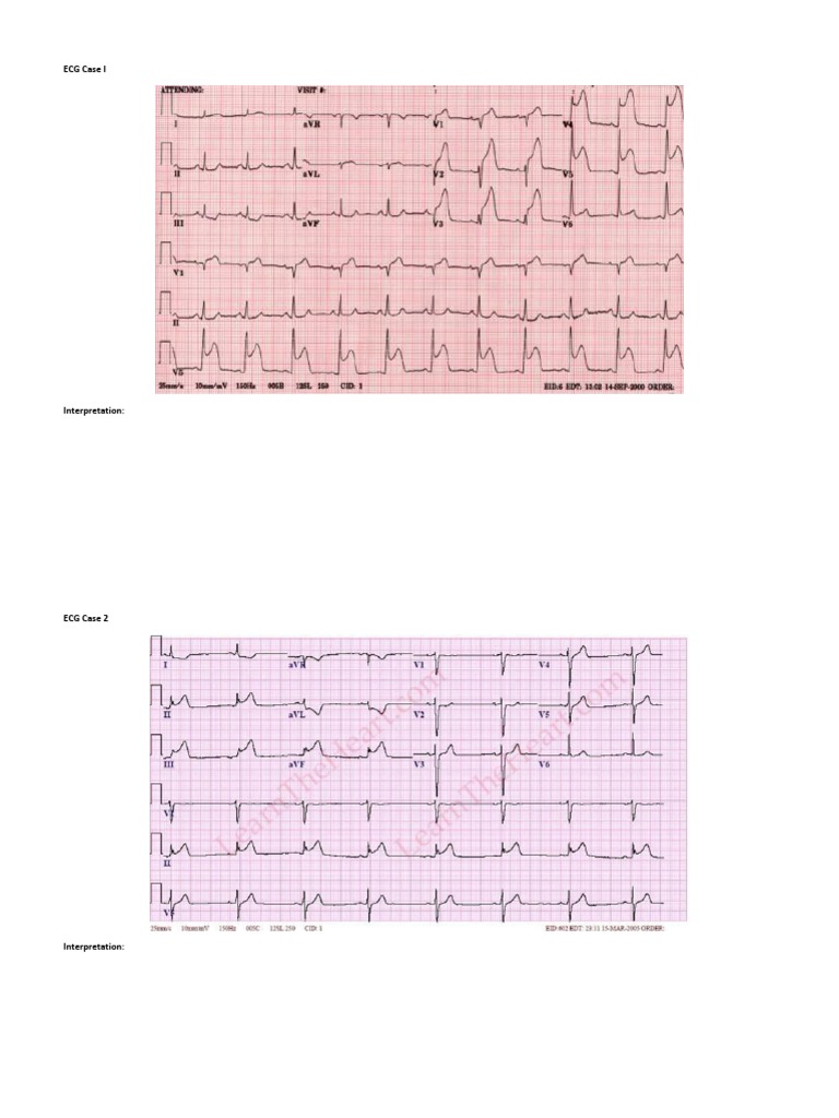 ECG Interpretation for Clinicians | PDF