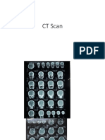 CT Scan Imaging - Computed Tomography Explained