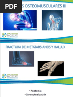 Fracturas de Jones | PDF | Hueso | Traumatologia