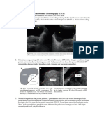 Cara Membaca USG Prostat Transabdominal Ultrasonography