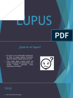 Lupus