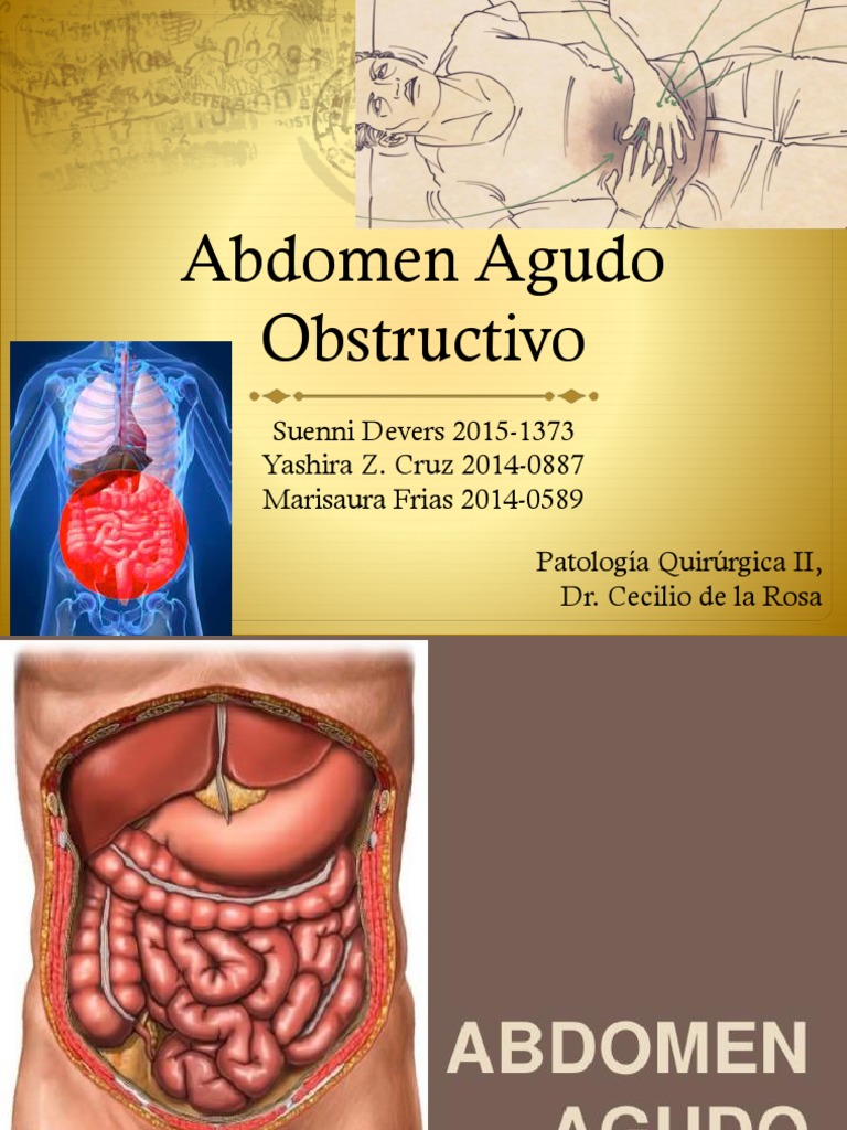 Abdomen Agudo Obstructivo Abdomen Especialidades Medicas Prueba gratuita de 30 días Scribd
