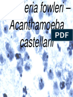 Naegleria Fowleri - Acanthamoeba Castellani