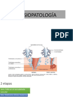 fisiopatologia preeclampsia