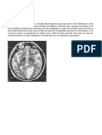 Casos de Neuro Completinho