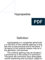 Hypospadias