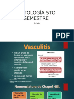 Vasculitis 