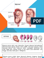 Materi Askep Bumil DGN PLASENTA PREVIA