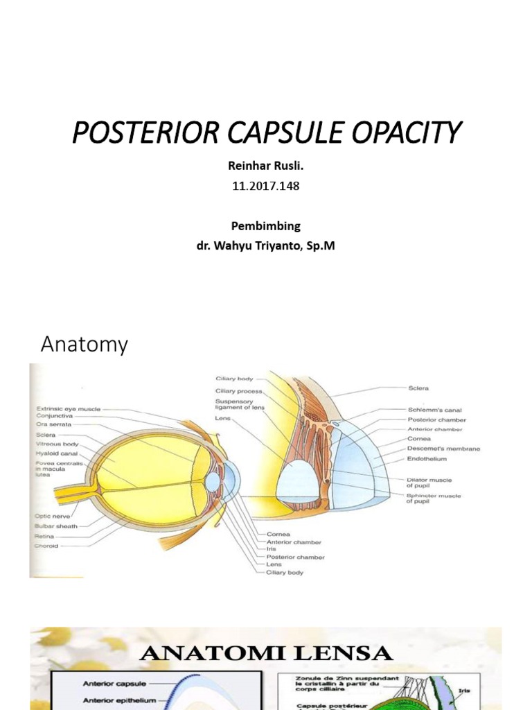 Posterior Capsule Opacity PDF