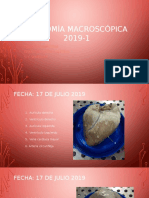 Disección Cardiaca