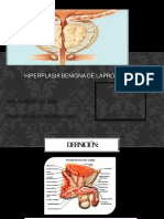 Escuela Demédica: Hiperplasia Benigna de Lapróstata