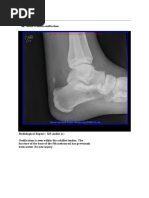 Download Ankle by Nader ElSayed SN42326853 doc pdf