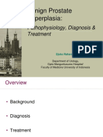 Benign Prostate Hyperplasia:: Pathophysiology, Diagnosis & Treatment
