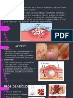 ABSCESOS