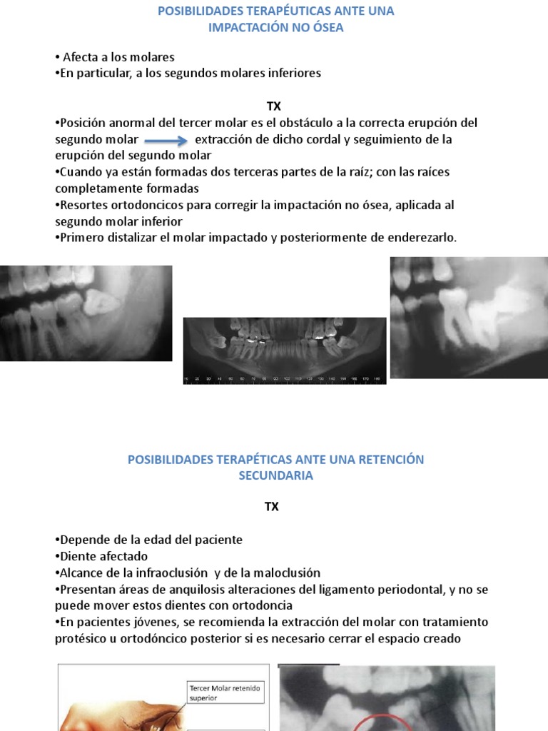 Exposicion Cirugia Dientes Incluidos | PDF | Diente | Ortodoncia