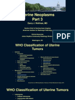 Wolfman - Uterine - Neoplasms-Part 3 - RCRT - Handout K