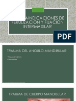 Ferulizacion y Fijacion Intermaxilar (I y C)