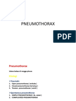 Pneumothorax