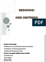 Radiologi Ileus Obstruksi