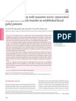 Facial Reanimation With Masseter Nerve-Innervated Free Gracilis Muscle Transfer in Established Facial Palsy Patients