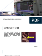 Intraoperative Monitoring: Dr. M. Fadhillah