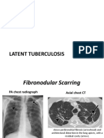 TB Radiology