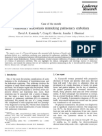 Pulmonary Leukostasis Mimicking Pulmonary Embolism: Case of The Month