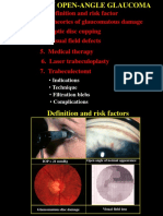 Primary Open Angle Glaucoma