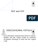 5.fistula 29.7.19