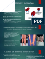 Edema Intracelular y Extracelular