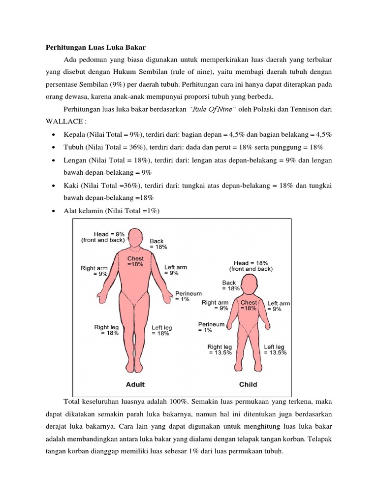 Perhitungan Luas Luka Bakar