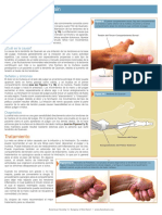 DeQervainESP (3).pdf