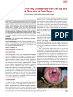 Rehabilitation of A One-day-Old Neonate With Cleft Lip and Palate Using Palatal Obturator: A Case Report