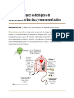 Terminos en Radiologia: Hidrotorax, Neumo Torax y Neumo Mediastino