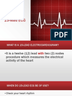 15 Lead ECG